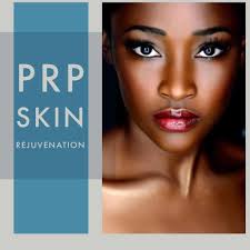 PRP facial treatment