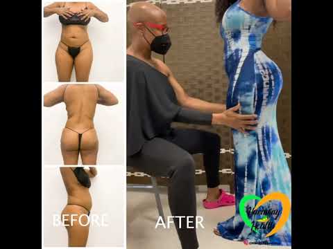 Harmony Health Cosmetic Clinic introduction video